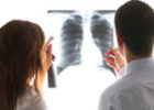 Những điều lưu ý dành cho người Ung thư phổi