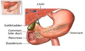 Ung thư dạ dày giai đoạn đầu cần lưu ý